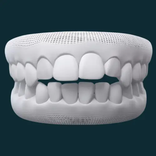 Overbite