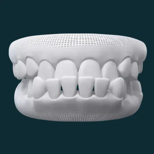 Underbite