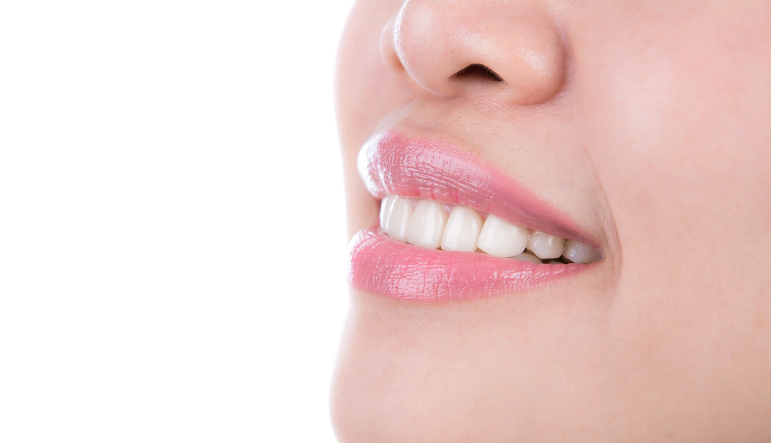Senyuman gigi cerah selepas rawatan whitening di Dentalane